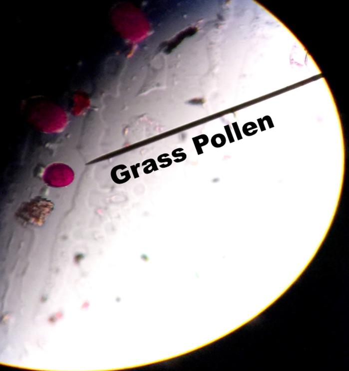 Grass Pollen on Slide | Asthma Center